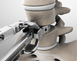 disc-replacement-surface-preperation